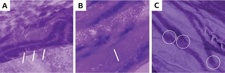 Gelişen Teknolojiyle Gün yüzüne çıkan detaylar