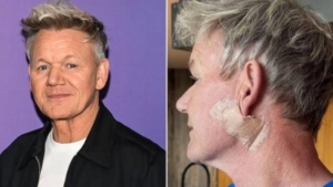gordon-ramsay-gunese-dair-uyari-gunes-kremi-kullanimi-icin-cagrisi-ve-cilt-sagligi-sRqzI5JZ.jpg