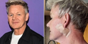 gordon-ramsay-gunese-dair-uyari-gunes-kremi-kullanimi-icin-cagrisi-ve-cilt-sagligi-sRqzI5JZ.jpg